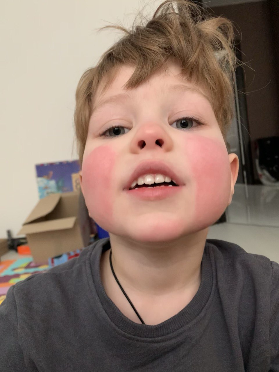 Холодовий дерматит. Мінімізуємо та захищаємось